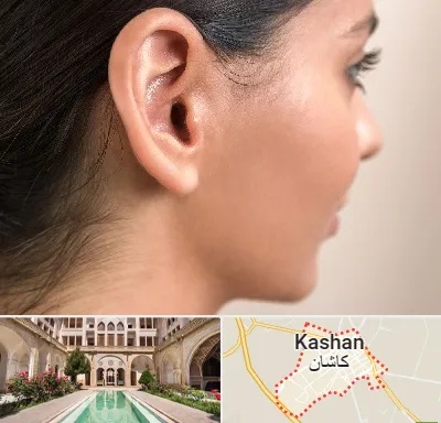 عمل گوش بل در کاشان