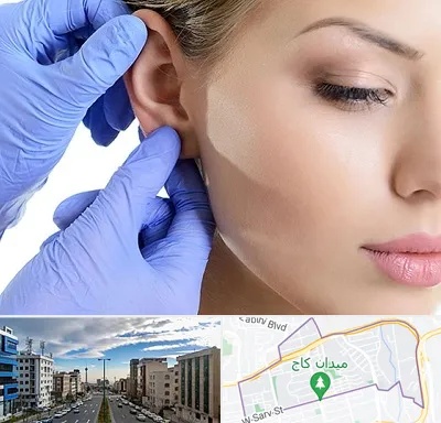 اتوپلاستی در سعادت آباد 