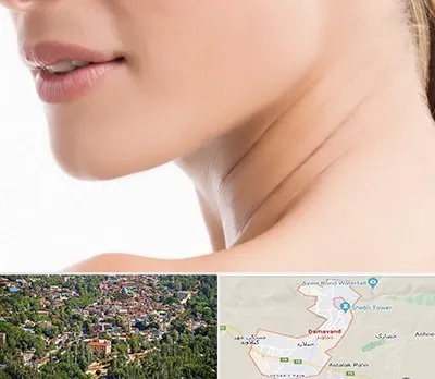 جراحی فک با لیزر در دماوند