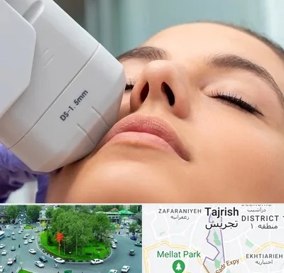 هایفوتراپی در تجریش 