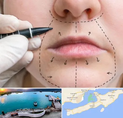 عمل سانترال لب در قشم