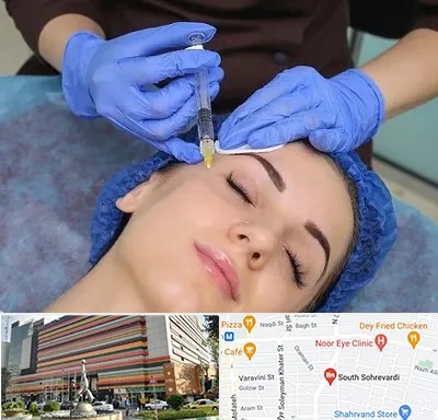 تزریق پروفایلو در سهروردی 