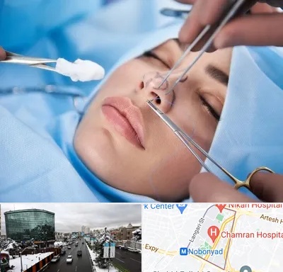 عمل ترمیمی بینی در اقدسیه 