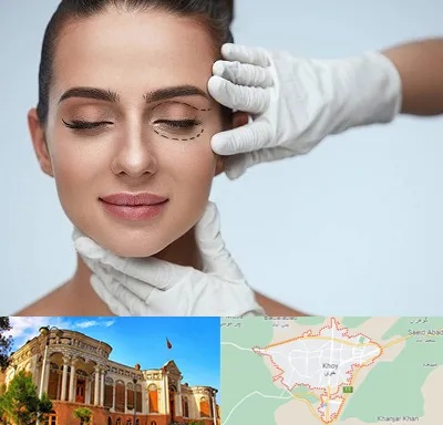 عمل پف چشم در خوی