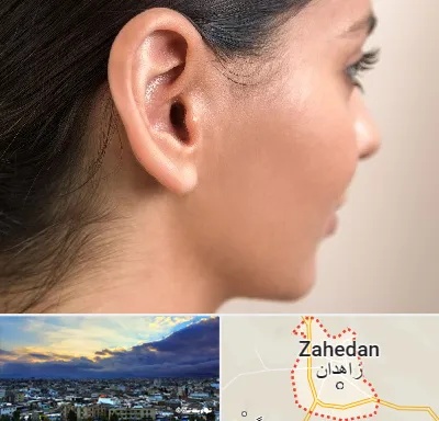 عمل گوش بل در زاهدان