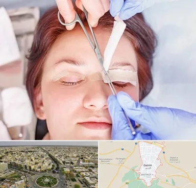 جراحی پلک افتاده در قزوین