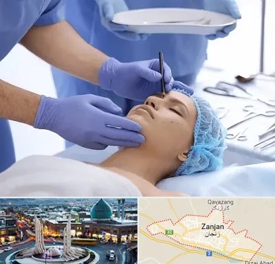 عمل بینی طبیعی در زنجان