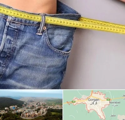 عمل لیپوماتیک در گرگان