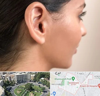 عمل گوش بل در جهانشهر کرج 