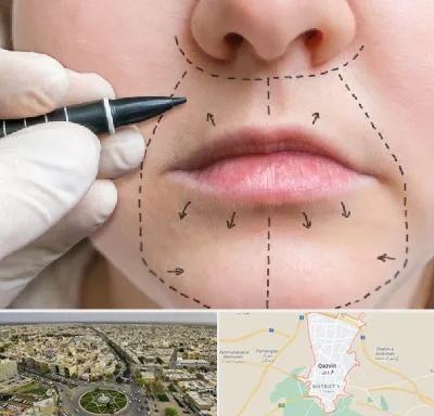 عمل سانترال لب در قزوین