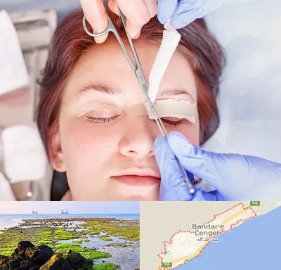 جراحی پلک افتاده در بندرلنگه