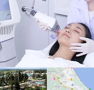 وایتنینگ در رودسر