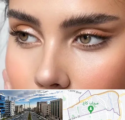 کانتو پلاستی در سعادت آباد 