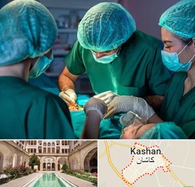 عمل کوچک کردن سینه در کاشان