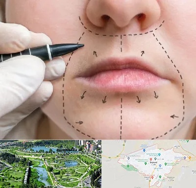 عمل سانترال لب در بجنورد