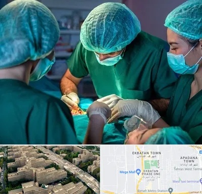 عمل کوچک کردن سینه در اکباتان 