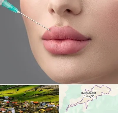 کلینیک ژل لب روسی در کلاردشت