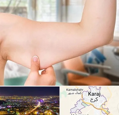 براکیوپلاستی در کرج