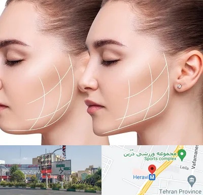 جراحی بوکال فت در هروی 