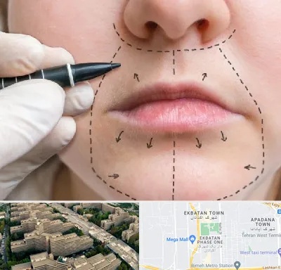 عمل سانترال لب در اکباتان 