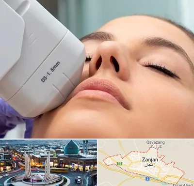 هایفوتراپی در زنجان