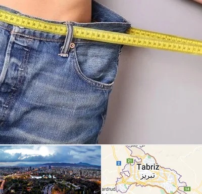 عمل لیپوماتیک در تبریز