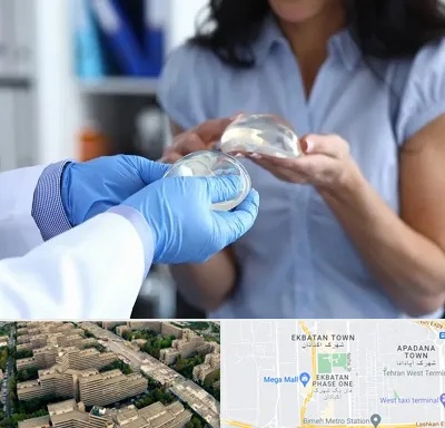 پروتز باسن در اکباتان 