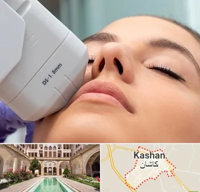 هایفوتراپی در کاشان
