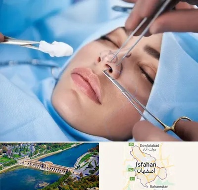 عمل ترمیمی بینی در اصفهان