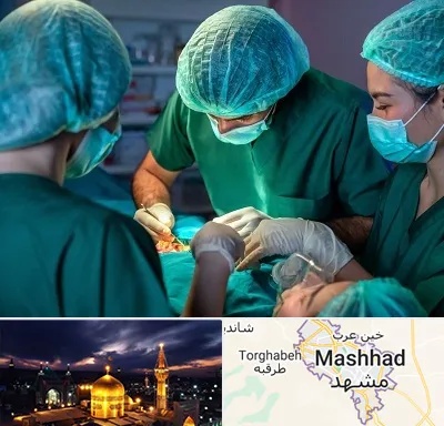 عمل کوچک کردن سینه در مشهد
