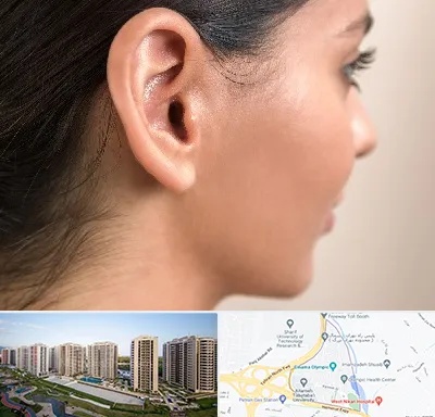 عمل گوش بل در المپیک 