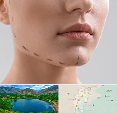 عمل زاویه فک در رودبار