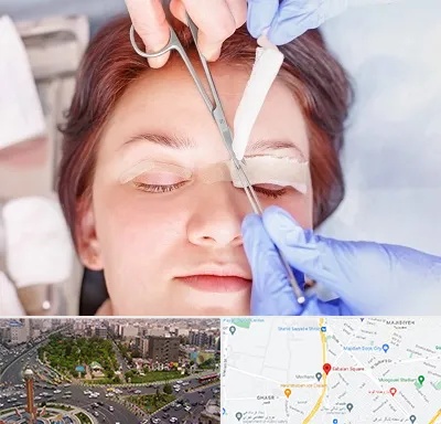 جراحی پلک افتاده در سبلان 