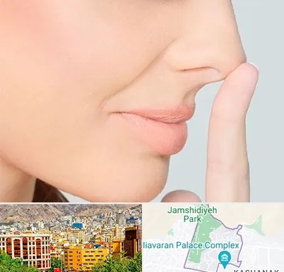 عمل تیپ پلاستی بینی در نیاوران 