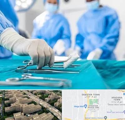 مونس پلاستی در اکباتان 