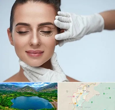 عمل پف چشم در رودبار
