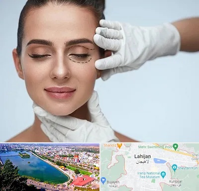 عمل پف چشم در لاهیجان