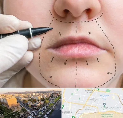 عمل سانترال لب در تهرانپارس 