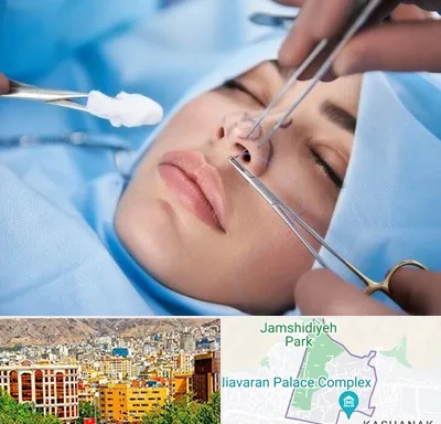 عمل ترمیمی بینی در نیاوران 