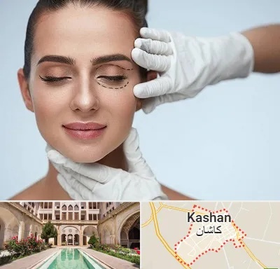 عمل پف چشم در کاشان