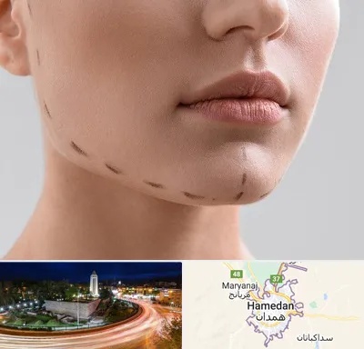 عمل زاویه فک در همدان