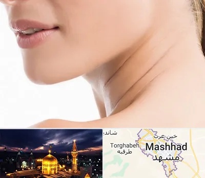 جراحی فک با لیزر در مشهد