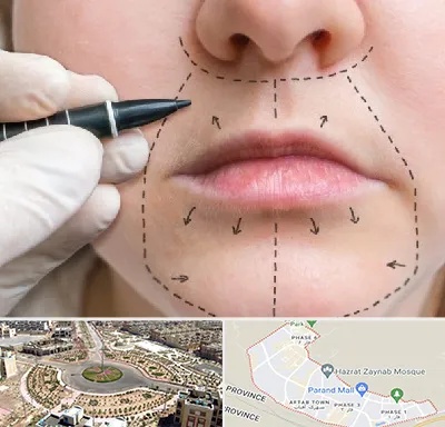 عمل سانترال لب در پرند