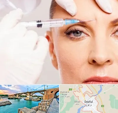 مزوژل در دزفول