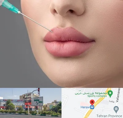 کلینیک ژل لب روسی در هروی 