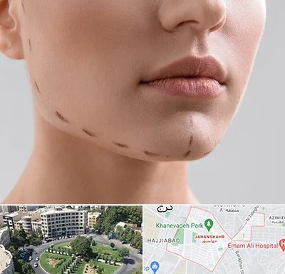 عمل زاویه فک در جهانشهر کرج 