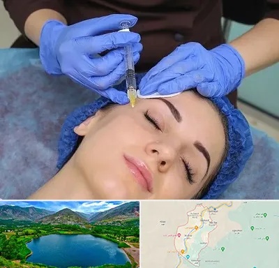تزریق پروفایلو در رودبار