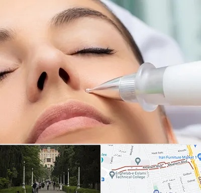 پلاسما جت بینی در بلوار معلم رشت 