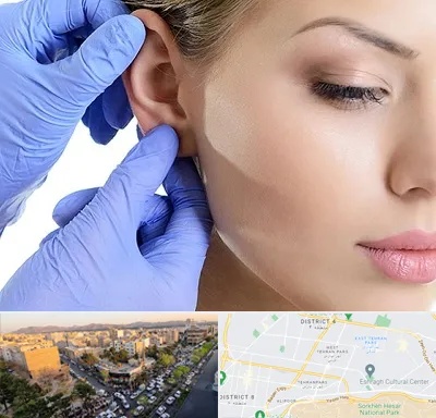 اتوپلاستی در تهرانپارس 