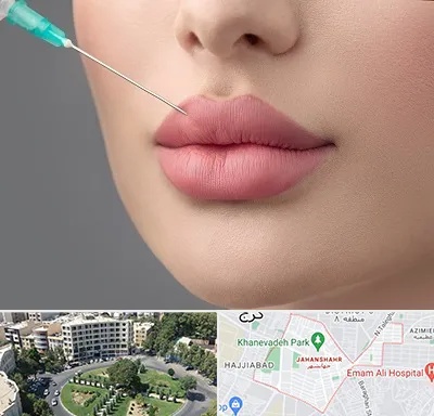 کلینیک ژل لب روسی در جهانشهر کرج 